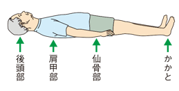 褥瘡の発生部位-仰臥位